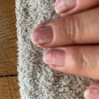 Lee Nails Bar - Nails after acrylic removal - Nail Salons Near Me - San Antonio, Texas
