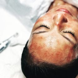 Sakura Skin And Mind - A Microneedling Treatment.