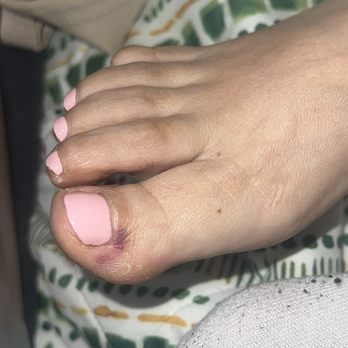 Family Nails - My mom's foot cut. - Nail Salons Near Me - Santa Ana, California Family Nails - My mom's foot cut. - Nail Salons Near Me - Santa Ana, California