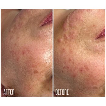 Lovely Beauty Palace - Aqua Facial Treatment - Estheticians Near Me - Bremen, HB Lovely Beauty Palace - Aqua Facial Treatment - Estheticians Near Me - Bremen, HB