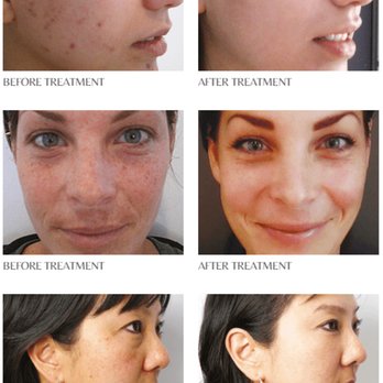 Meridian MedSpa - Medical Spas Near Me - Miami, Florida Meridian MedSpa - Medical Spas Near Me - Miami, Florida