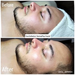 Eva Esthetics