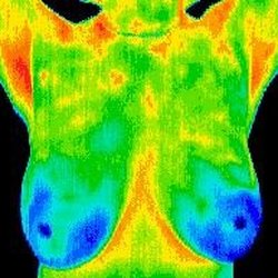 The Thermography Center