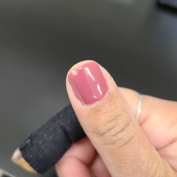 Mt. Diablo Nails Salon - Chipped gel manicure. - Nail Salons Near Me - Lafayette, California Mt. Diablo Nails Salon - Chipped gel manicure. - Nail Salons Near Me - Lafayette, California