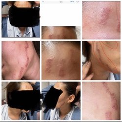 Yung Tin, MD - The evidence of they burned customer's Face