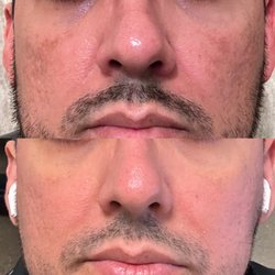 California Skin & Laser Center