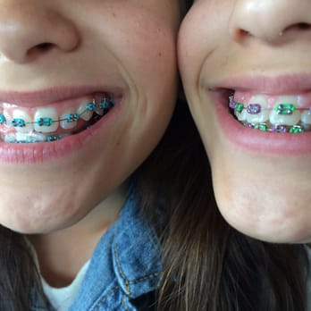 VP Smiles Orthodontics - Twins with braces!! - Orthodontists Near Me - Placentia, California VP Smiles Orthodontics - Twins with braces!! - Orthodontists Near Me - Placentia, California