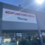 Photo of Acupuncture Moxa Therapy