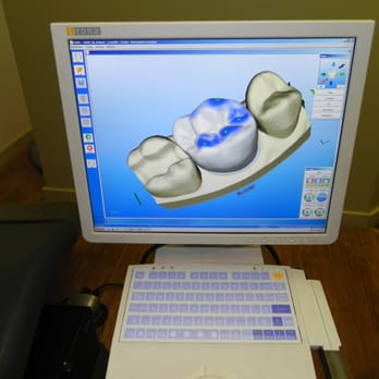 Kits Point Dental Group - CEREC one appointment crowns/onlays/inlays - General Dentistry Near Me - Vancouver, British Columbia Kits Point Dental Group - CEREC one appointment crowns/onlays/inlays - General Dentistry Near Me - Vancouver, British Columbia