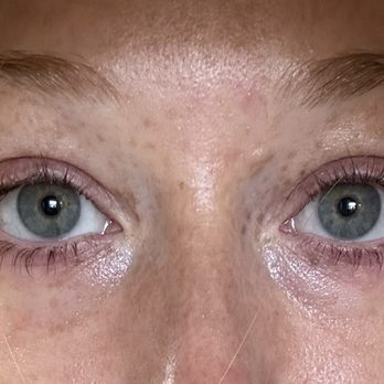 The Lash Lounge - Lash lift after 10 days - Eyelash Service Near Me - Plano, Texas The Lash Lounge - Lash lift after 10 days - Eyelash Service Near Me - Plano, Texas