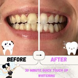 Tooth Fairy Waifu - 30min white before and after
