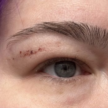Honey Nail Spa - The damage to my eyelid from over waxing - Nail Salons Near Me - Locust Grove, Virginia Honey Nail Spa - The damage to my eyelid from over waxing - Nail Salons Near Me - Locust Grove, Virginia