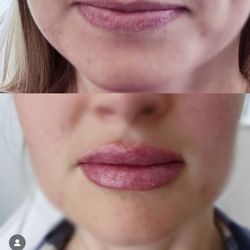 Reve Medical Aesthetics