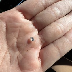 Wendy's - Imagine chewing and then you bite down on this. You'd feel the same way