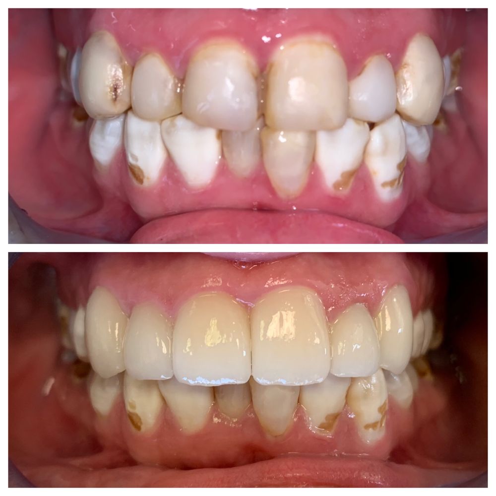 SCHROEDER COSMETIC AND FAMILY DENTISTRY Updated July 2024 19 Photos