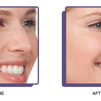 Hackensack Medspa - Tattoo Removal Near Me - Hackensack, New Jersey Hackensack Medspa - Tattoo Removal Near Me - Hackensack, New Jersey