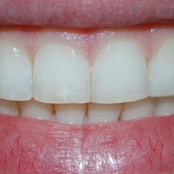 Pembroke Dental Ballsbridge