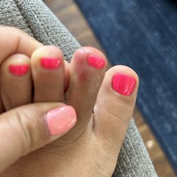 Nail infection from pedicure