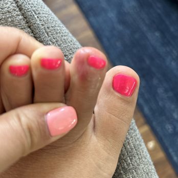 EZ Nails - Nail infection from pedicure - Nail Salons Near Me - Torrance, California