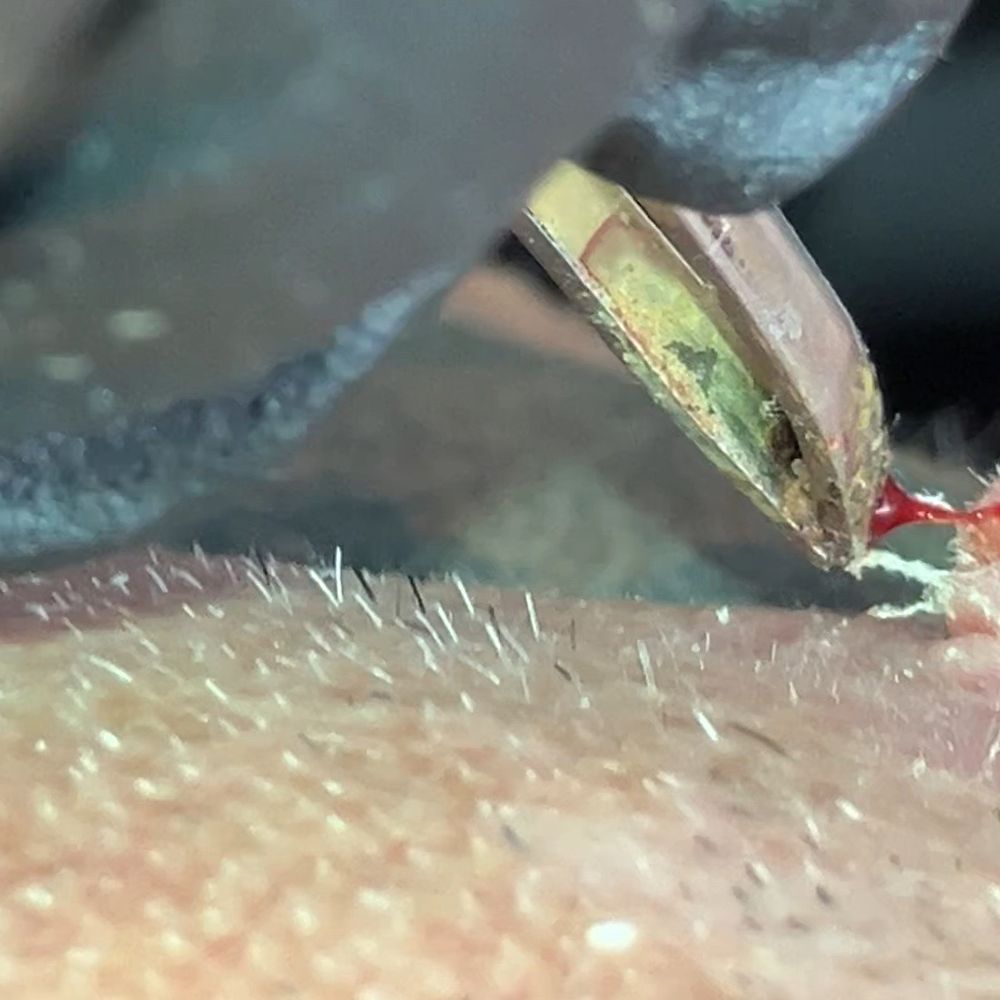 Regency Dermatology - Not a scratch - Dermatologists Near Me - Surprise, Arizona Regency Dermatology - Not a scratch - Dermatologists Near Me - Surprise, Arizona