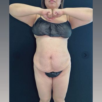 The Plastics Doc & Med Spa - Before procedure - Plastic Surgeons Near Me - Corona, California The Plastics Doc & Med Spa - Before procedure - Plastic Surgeons Near Me - Corona, California