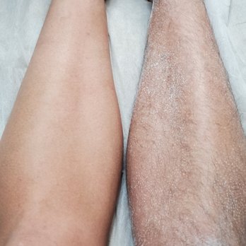 The Sugaring Spot - Mens leg Before and after - Sugaring Near Me - Chino, California The Sugaring Spot - Mens leg Before and after - Sugaring Near Me - Chino, California