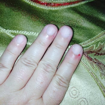 Ciao Bella Nails - Before nails. Chewed to stubs, no color, so so sad. Not at all fitting to the lady I am! - Nail Salons Near Me - San Francisco, California Ciao Bella Nails - Before nails. Chewed to stubs, no color, so so sad. Not at all fitting to the lady I am! - Nail Salons Near Me - San Francisco, California