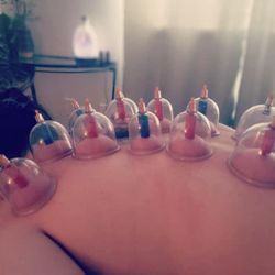 Massage by Natalie & Co - Cupping Therapy/Deep Tissue Massage