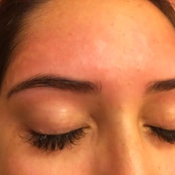 Vela Nails & Spa - Red bumps after waxing all over my forehead and I've NEVER gotten bumps, I wax all the time. - Nail Salons Near Me - Covina, California Vela Nails & Spa - Red bumps after waxing all over my forehead and I've NEVER gotten bumps, I wax all the time. - Nail Salons Near Me - Covina, California