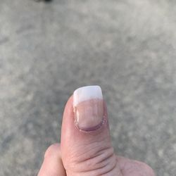 Merrillville Nail Luv - Nail with the weak area on the left.