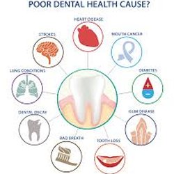 Cascade Hygiene Mobile Dental Care - Dental Care is so important to overall health in seniors and people with disabilities.
