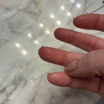 Studio 89 Spa - Side view of finger with pus. - Nail Salons Near Me - Sandyston , New Jersey
