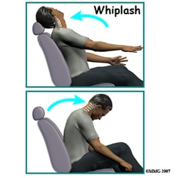 Century Massage - Another view of whiplash injury