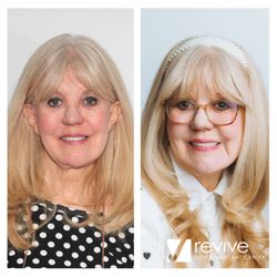 Revive Dental Implant Center - Revive Dental Implant Center. Mesa, AZ. Dental Implants