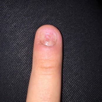 The Nail Bar - It's been 5 months and it still hasn't grown back NOT EVEN A LITTLE. - Nail Salons Near Me - Burbank, California