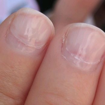 Pretty Nails - Destroyed nails - Nail Salons Near Me - Fremont, California Pretty Nails - Destroyed nails - Nail Salons Near Me - Fremont, California