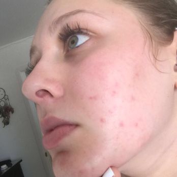Skin by Fatima - Now - Skin Care Near Me