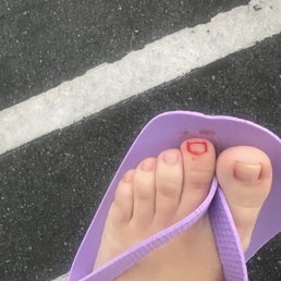 Horrible pedicure