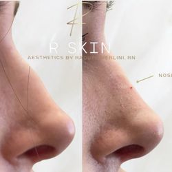 R Skin Aesthetics by Raquel