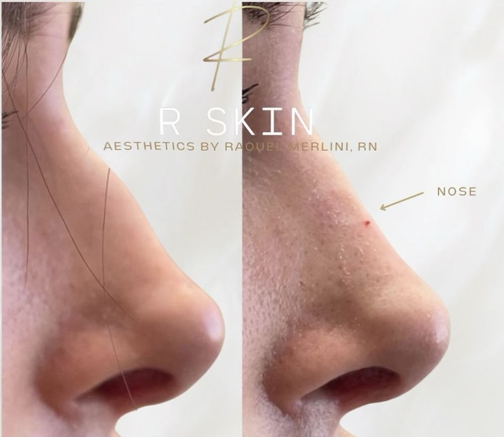 R Skin Aesthetics by Raquel Logo