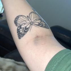 Family Care Network - Bellingham Bay Family Medicine - Swollen & bruised after lab work