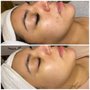 Photo of Skin Deep By Whitney at Nurtura Medspa