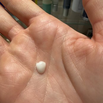 CG Smile - Veneer that fell off after approximately 4 weeks while simply flossing. - Cosmetic Dentists Near Me - Miami, Florida