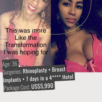 Plastic Surgery in Tijuana - This is the kind of before and after I was expecting. - Health & Medical Near Me - Tijuana, BCS