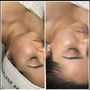 After Glow Esthetics