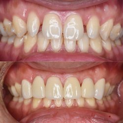 Pristine Dental Service - __Smile Makeover__  Call us for FREE consultation