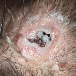 Suncoast Skin Solutions