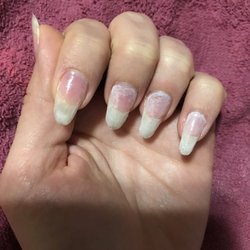 Mainely Nails - Destroyed nail beds using nail grinder for gel removal