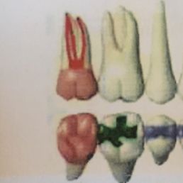 #2 tooth - only change is THEY worked on the tooth and now it's suddenly much worse off.
