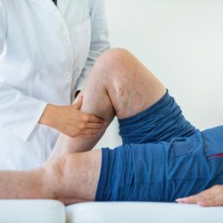 California Vein & Vascular Centers